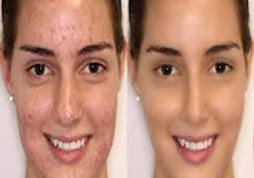photo retouching service